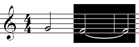 Haltebogen Encore Notation